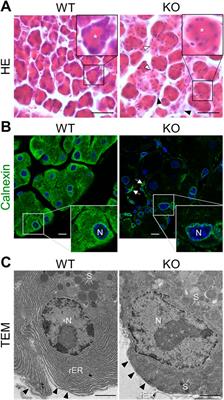 Loss of CAPS2/Cadps2 leads to exocrine pancreatic cell injury and intracellular accumulation of secretory granules in mice